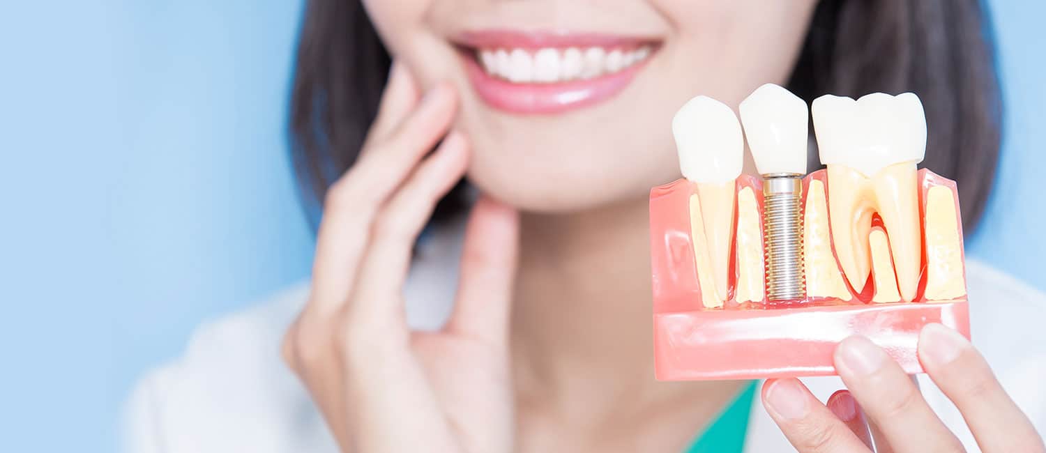 Dental Implants Treatment in Hyderabad