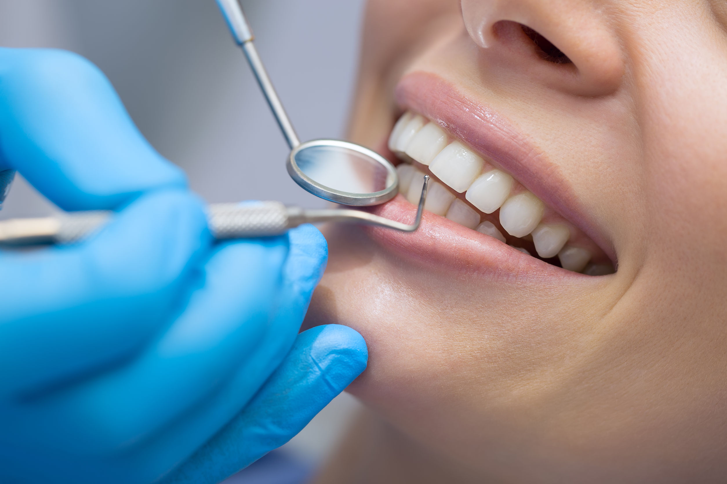 Best Dental Care Clinic | Top Dental Clinic in Hyderabad | Capture Life Dental  Care