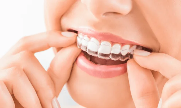 Cosmetic Dentist Near Hyderabad