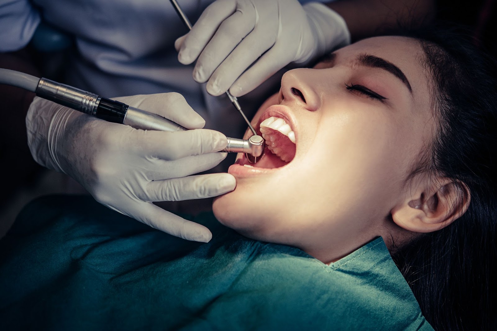 how-to-treat-swelling-following-dental-extraction-root-canal-treatment-hyderabad